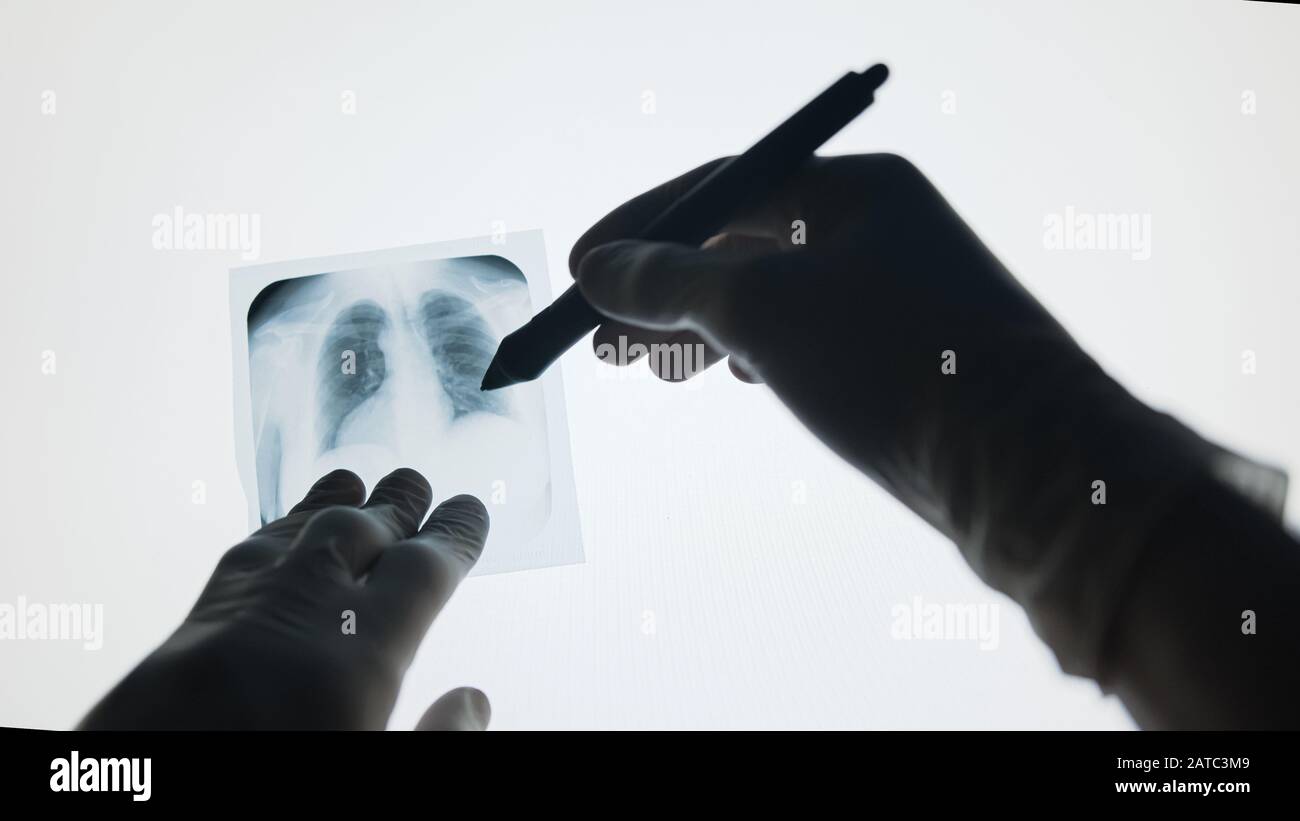 Doctor examining Xray searching diagnosis. Doctor pointing on xray