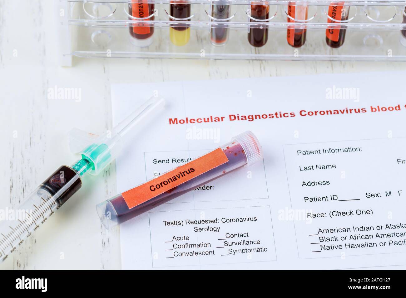 MERS virus definition Middle East Respiratory Syndrome Blood sample