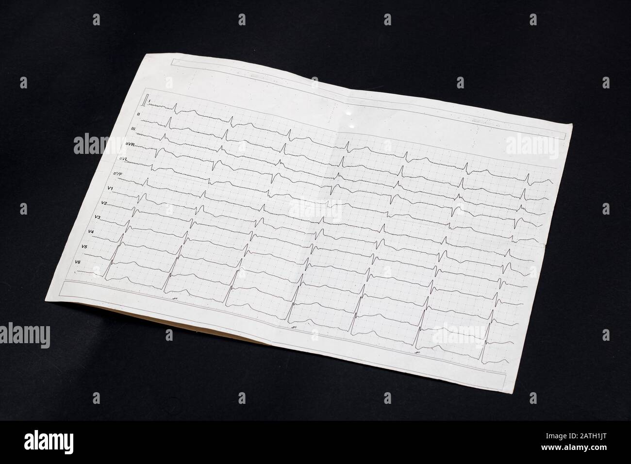 Cardiogram results on a black background closeup Stock Photo