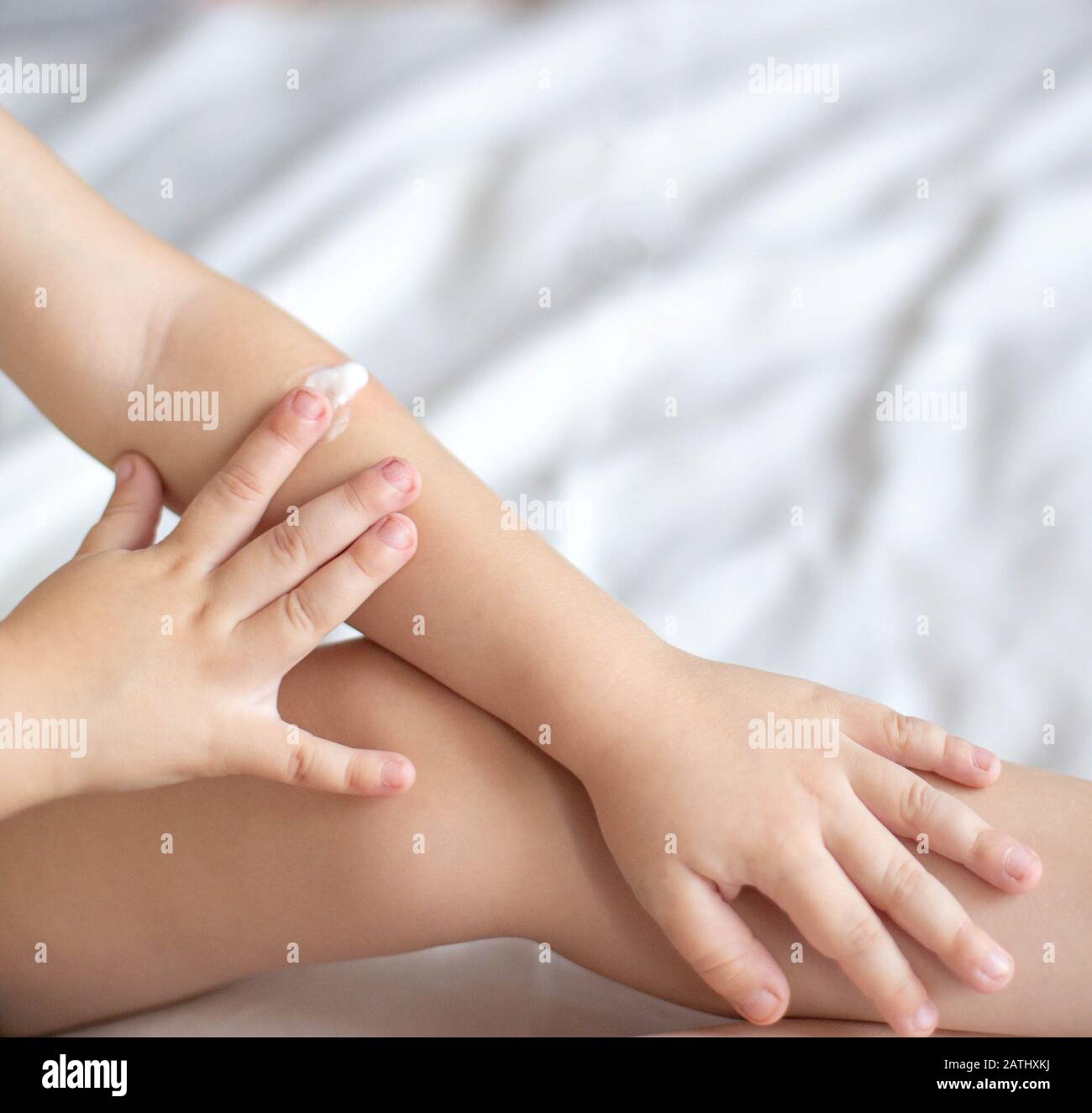 Burn child legs hires stock photography and images Alamy