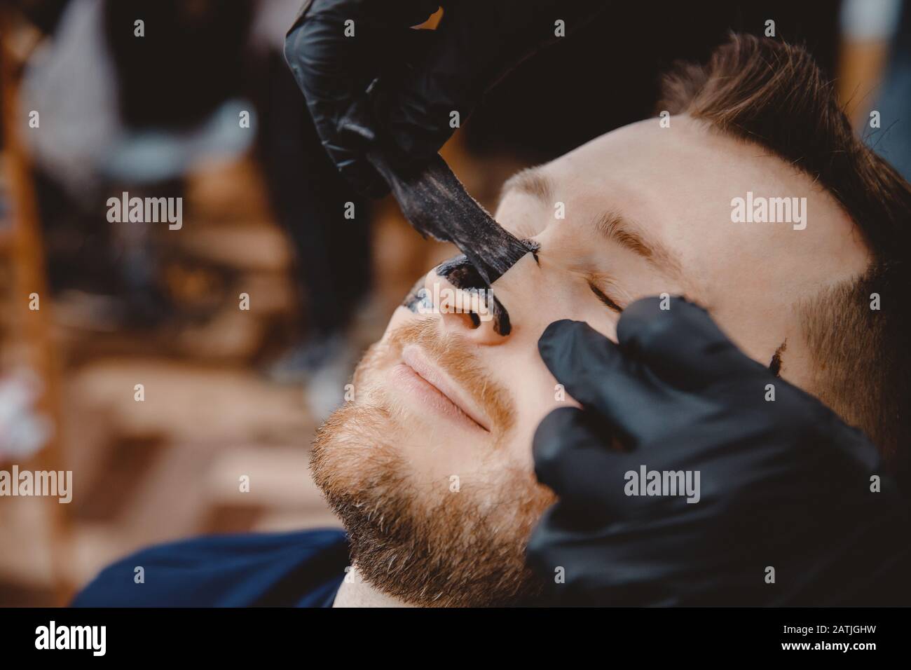 Acne Removal With Cosmetic Product Cleaning Pores Of Men Skin