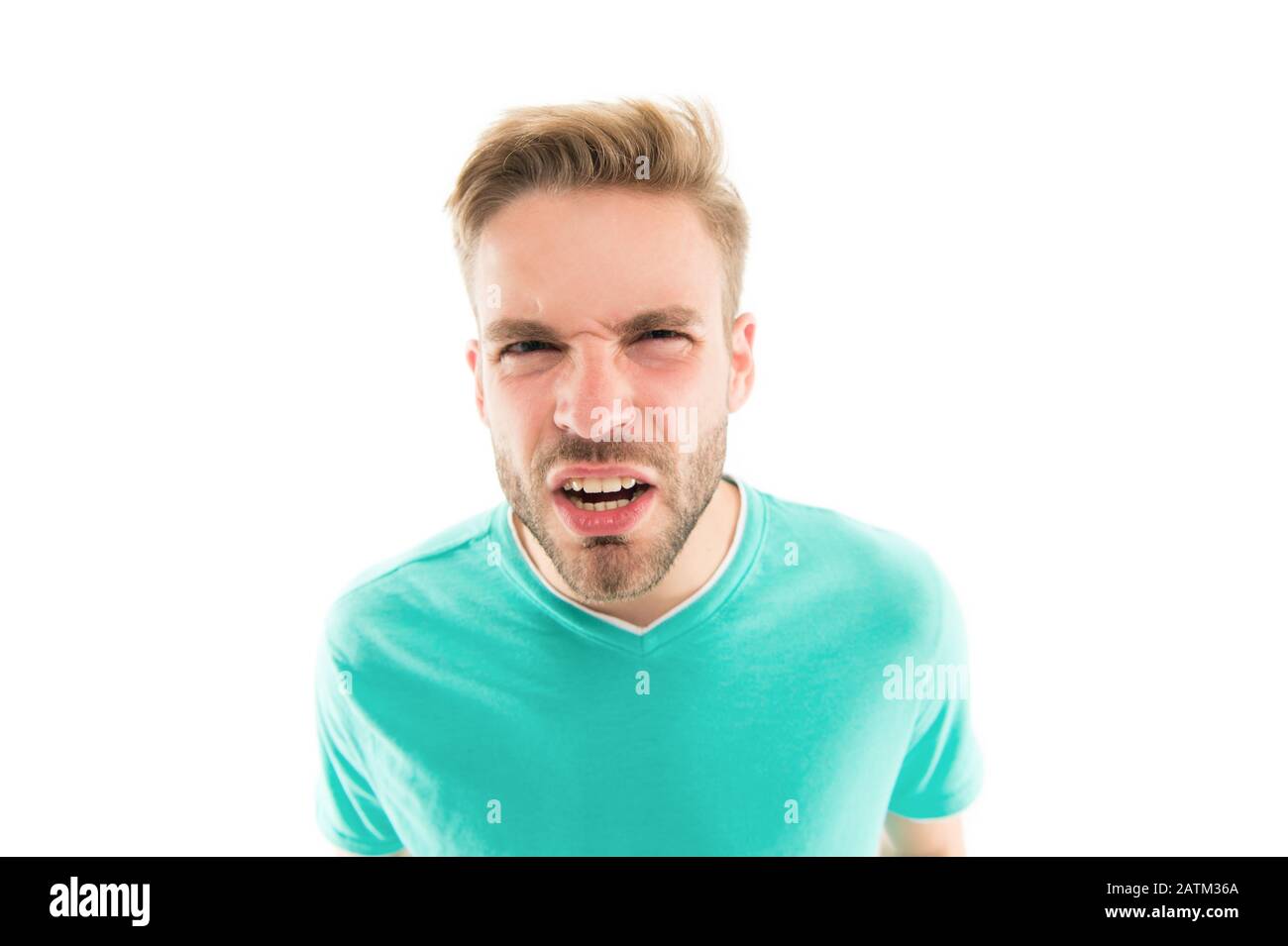 What Causes Hair Loss Gloomy Man With Blond Hair Handsome Guy