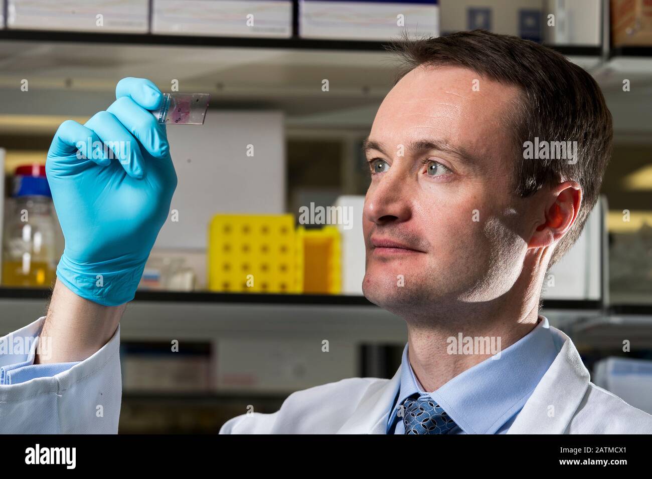 Oncologist Dr Richard Turkington who is part of a £300,000 charity-funded three-year programme with Queen's University Belfast that will investigate using the body's immune system to attack pancreas and throat tumours. Stock Photo