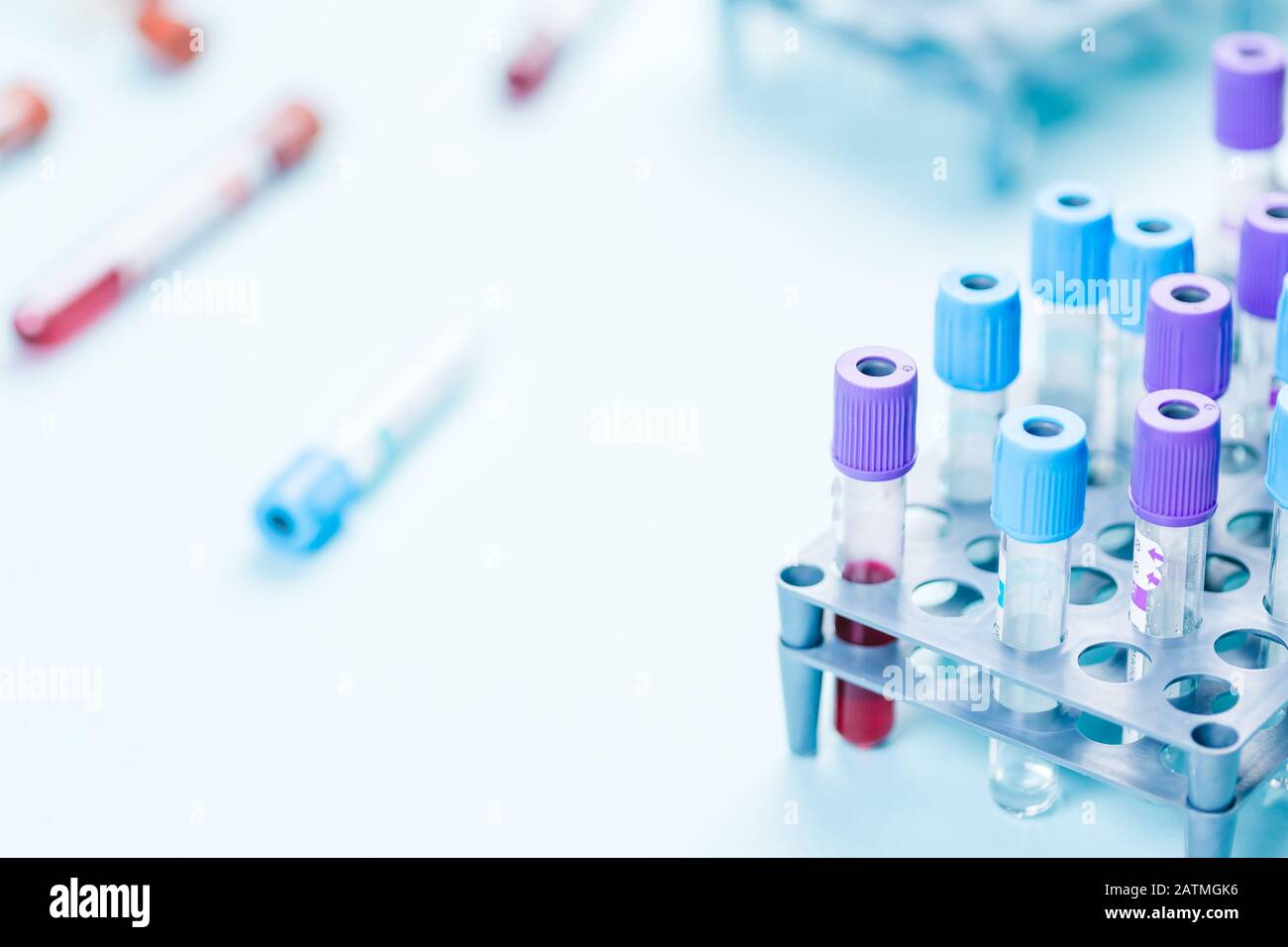 Tube vials with blood sample and medical samples in rake, medical