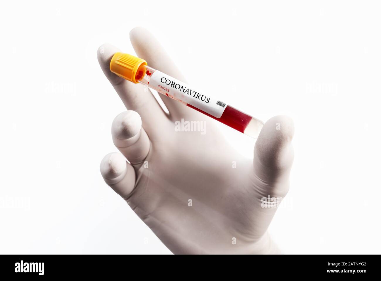 Blood Sample in a flask for analyzing Corona virus and producing vaccine. Corona virus outbreaking Stock Photo