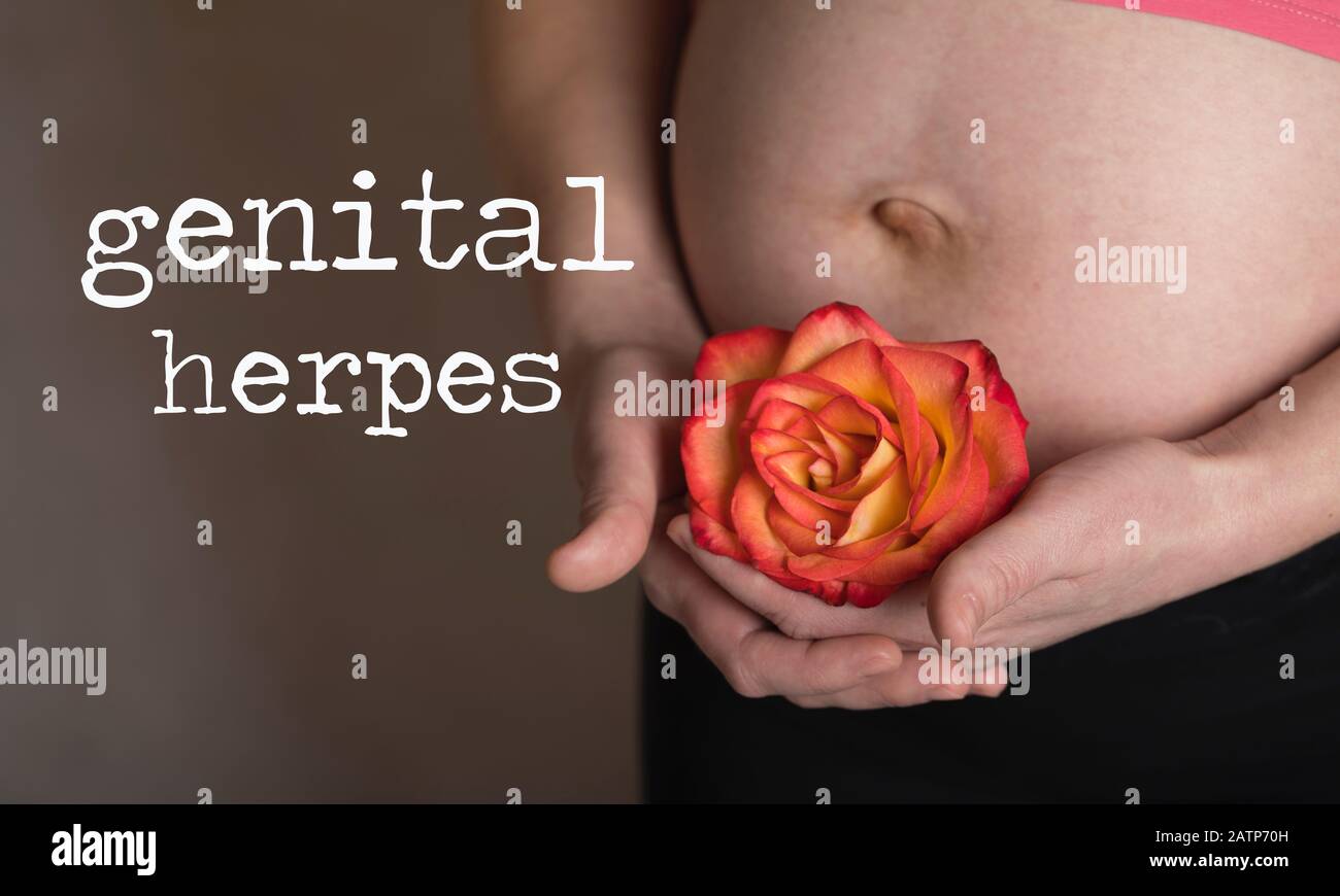 Words GENITAL HERPES. Young pregnant between 30 and 35 years old woman keeps rose blossom close to  her belly in the background. Closeup Stock Photo