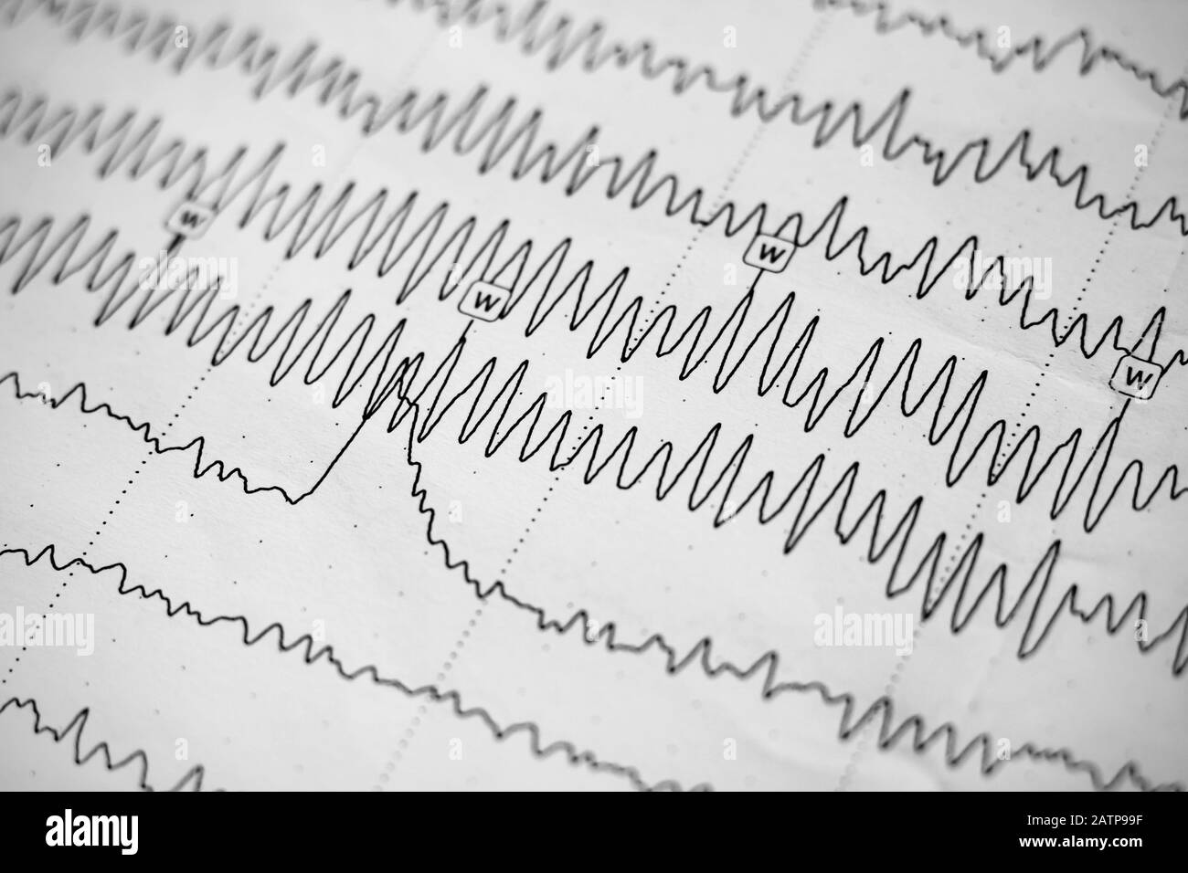 Electroencephalogram result on paper closeup, brain activity test Stock Photo