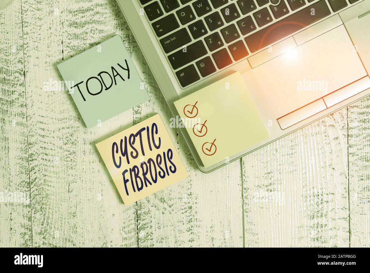 Conceptual Hand Writing Showing Cystic Fibrosis Concept Meaning A Hereditary Disorder Affecting The Exocrine Glands Metallic Laptop Three Sticky Note Stock Photo Alamy