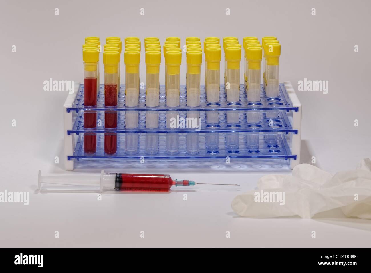 Microbiology lab biological virus concept with vacutainer blood tubes on rack. Clinical tests with equipment & syringe next to protective glove. Stock Photo