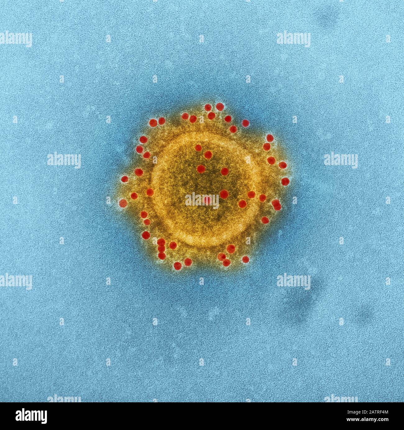 Highly magnified, digitally colorized transmission electron microscopic (TEM) image of the particle envelope of a single, spherical shaped, Middle East respiratory syndrome coronavirus (MERS-CoV) virion, 2014. MERs is in the same family as the novel coronavirus which began to infect patients in Wuhan, China in early 2020. Courtesy National Institute of Allergy and Infectious Diseases (NIAID)/CDC. Image produced in 2014. () Stock Photo