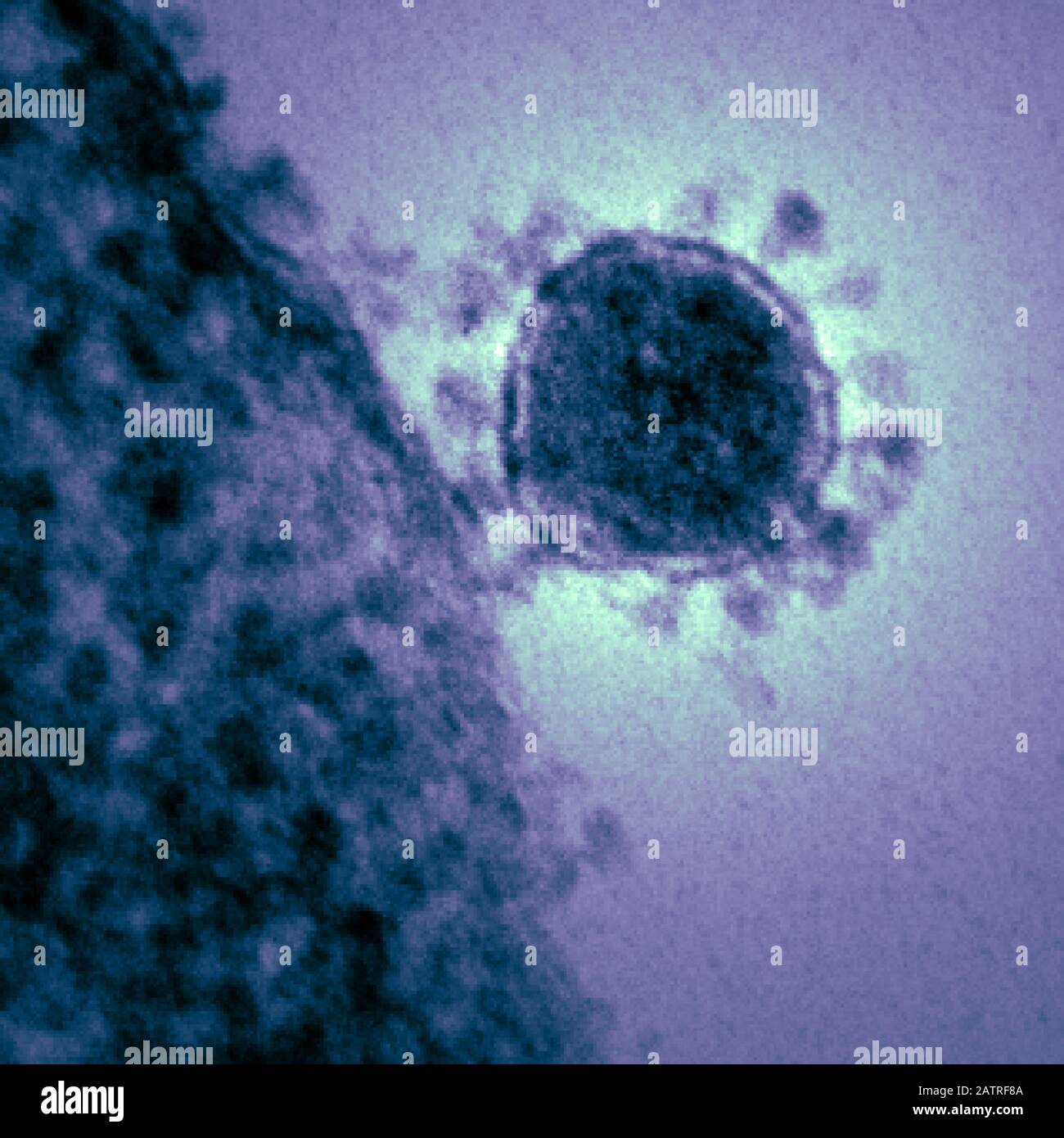 Highly magnified, digitally colorized transmission electron microscopic (TEM) image, showing ultrastructural details exhibited by a single, spherical shaped, Middle East respiratory syndrome coronavirus (MERS-CoV) virion, 2014. MERs is in the same family as the novel coronavirus which began to infect patients in Wuhan, China in early 2020. Courtesy National Institute of Allergy and Infectious Diseases (NIAID)/CDC. Image produced in 2014. () Stock Photo