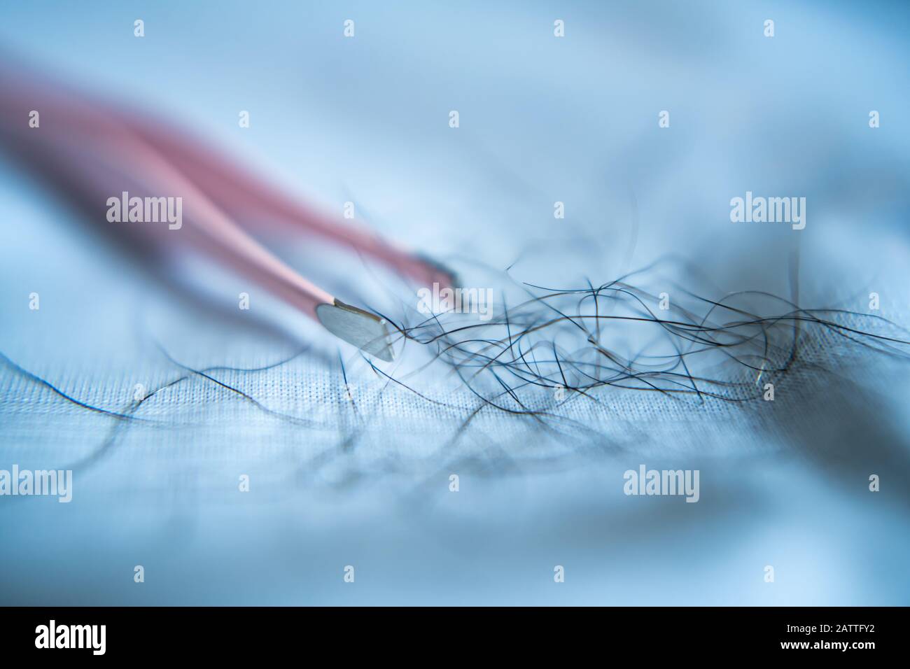 Tweezers and armpit hairs on blue cloth Stock Photo Alamy
