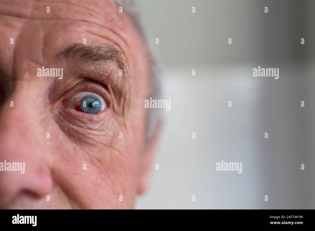 A man’s eye opened wide in surprise. Stock Photo