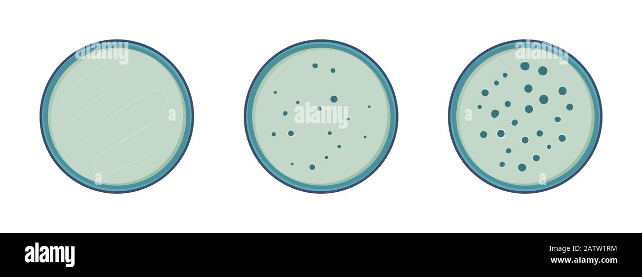 Microbiology. Colony bacteria growth in petry dish, 3 stages, vector flat style. Stock Vector