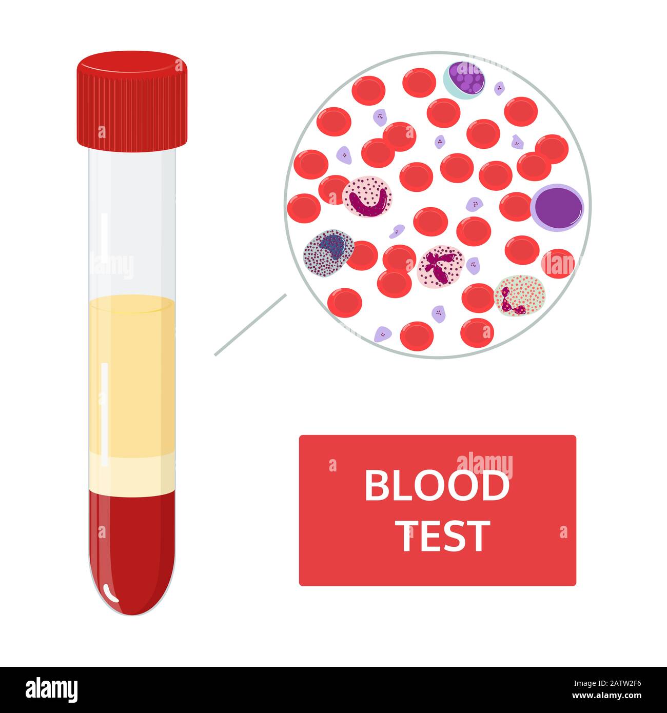 Medical vector concept: blood analysis in test tubes and a drop of blood under a microscope. Red and white blood cells image. Stock Vector