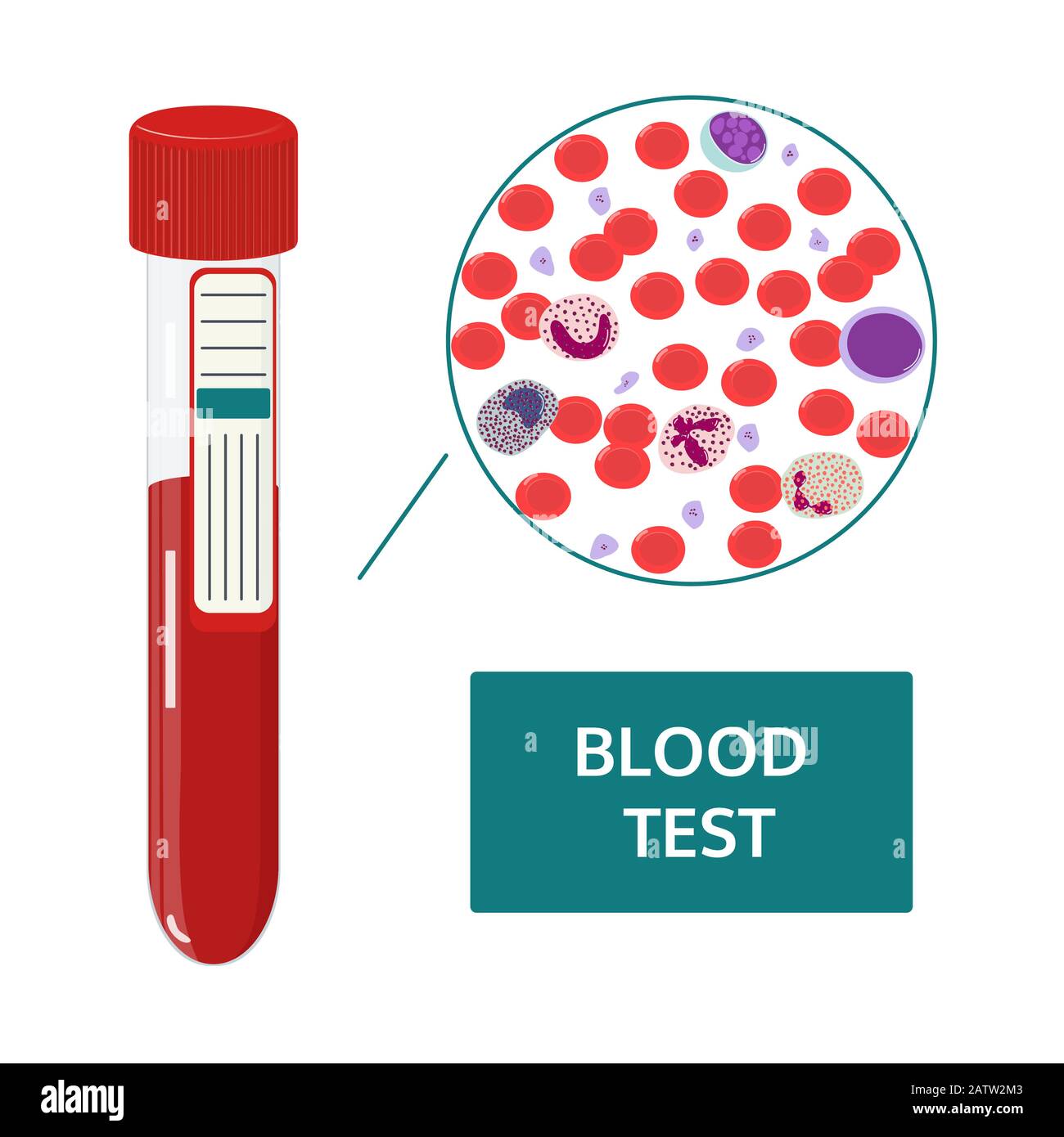 Medical vector concept: blood analysis in test tubes and a drop of blood under microscope. Red and white blood cells flat image. Stock Vector