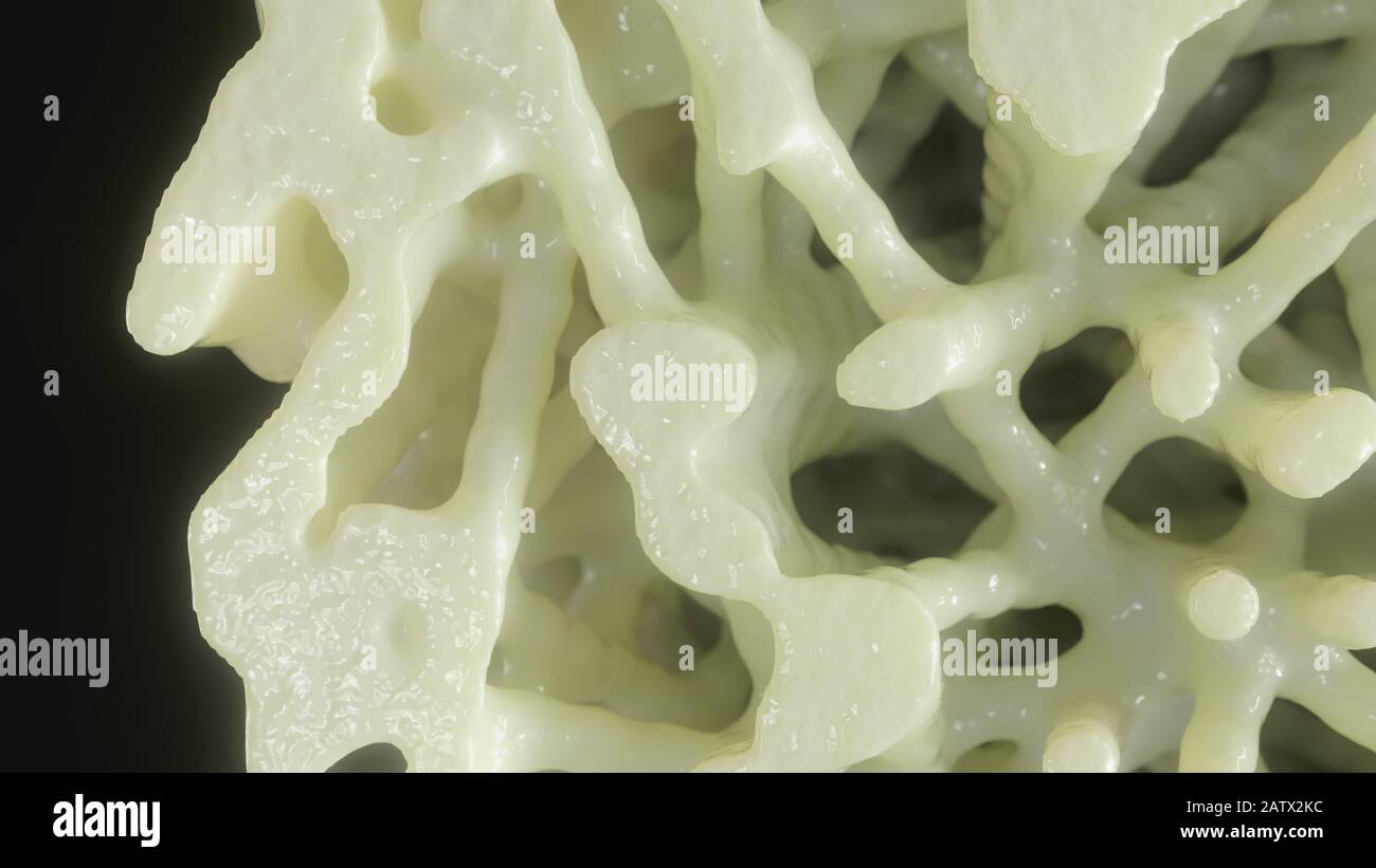 Bone affected with osteoporosis - cross section - 3D rendering Stock ...