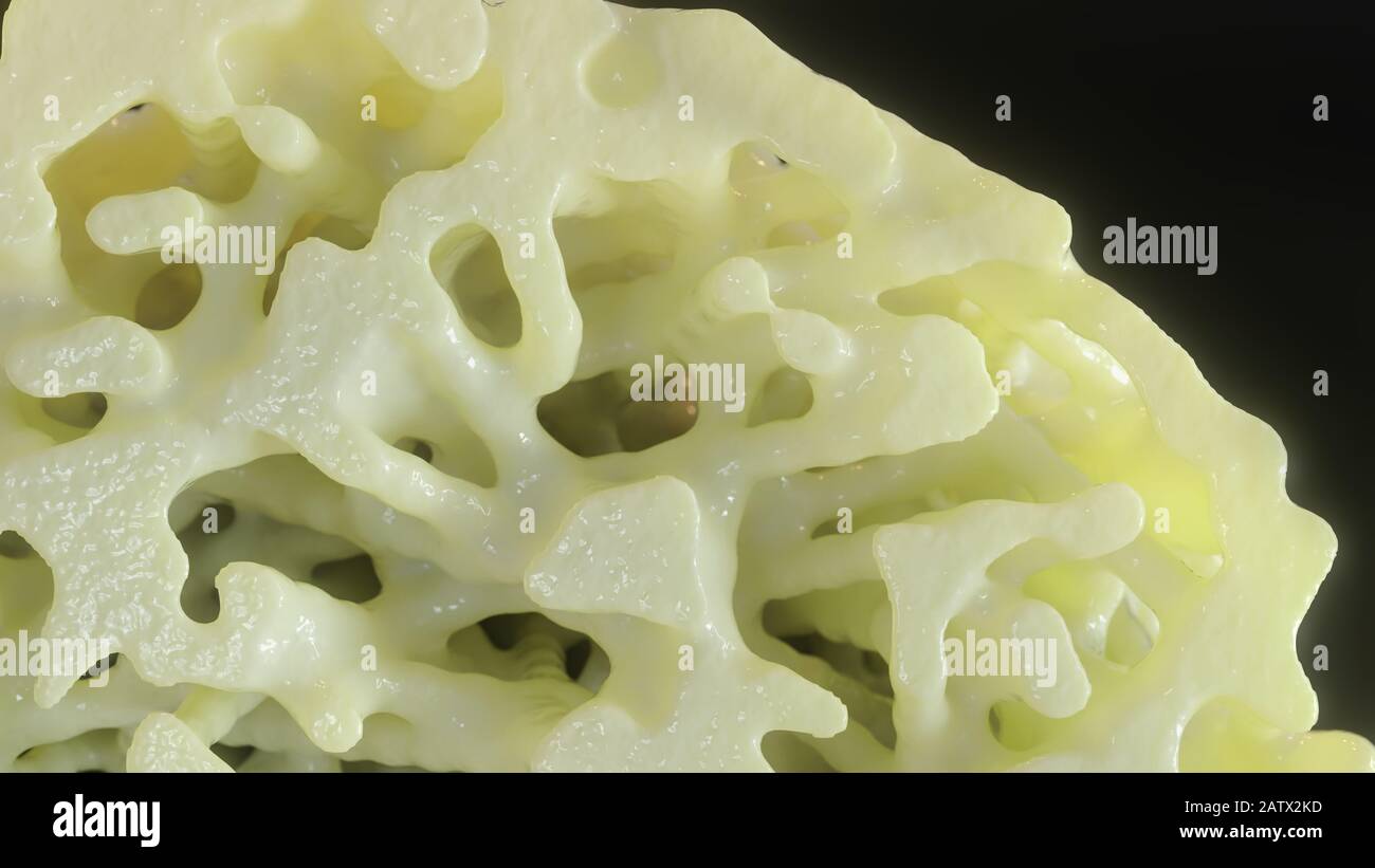 Bone affected with osteoporosis - cross section - 3D rendering Stock ...