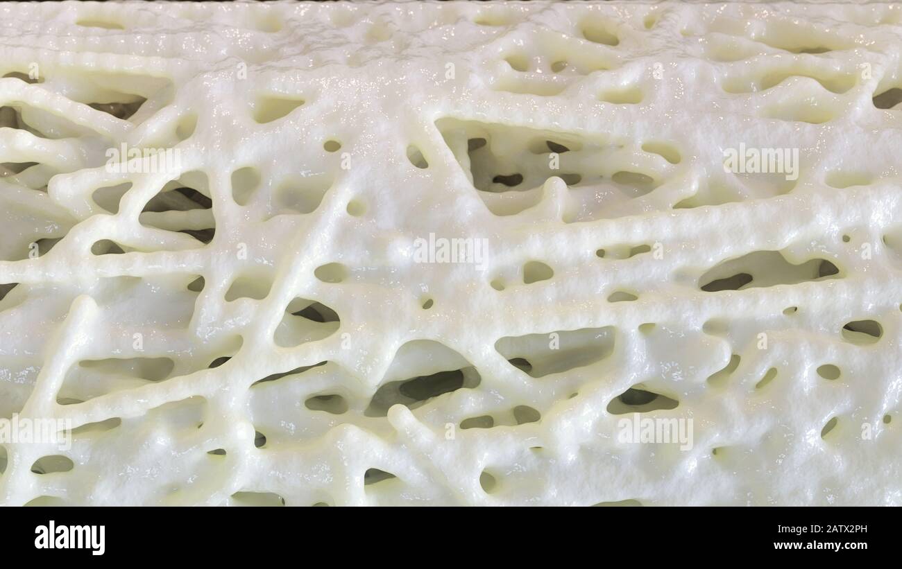 Bone affected with osteoporosis - cross section - 3D rendering Stock ...