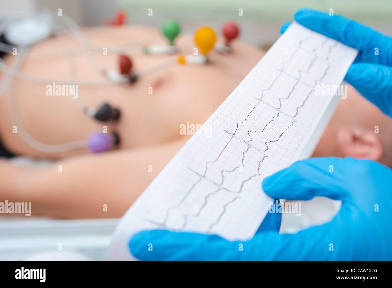 Heart cardiogram in the hands of a doctor close-up. Cardiologist is studying the testimony of an electrocardiograph. Stock Photo