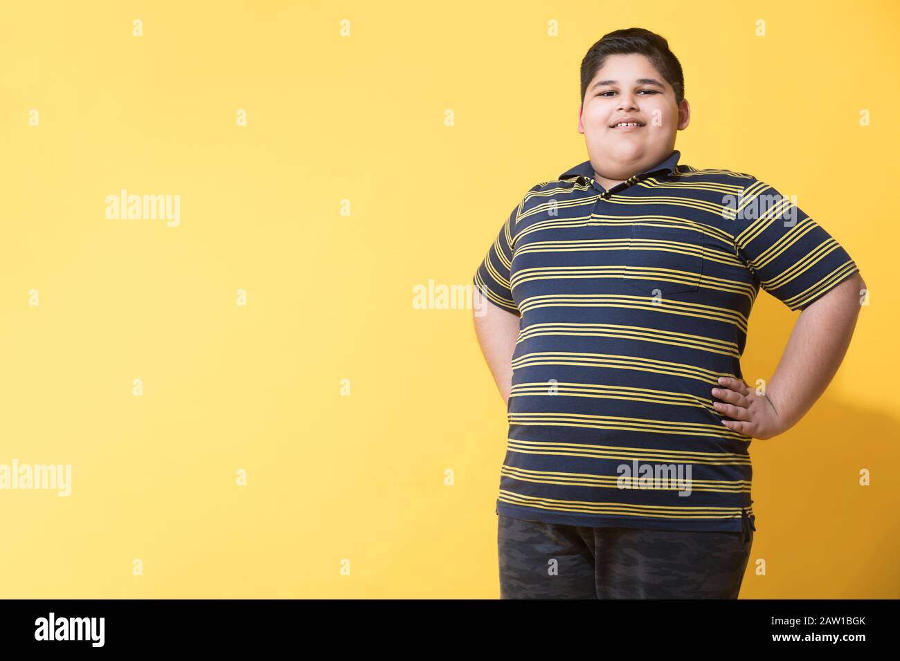 Obese boy standing and posing. (Obesity) Stock Photo