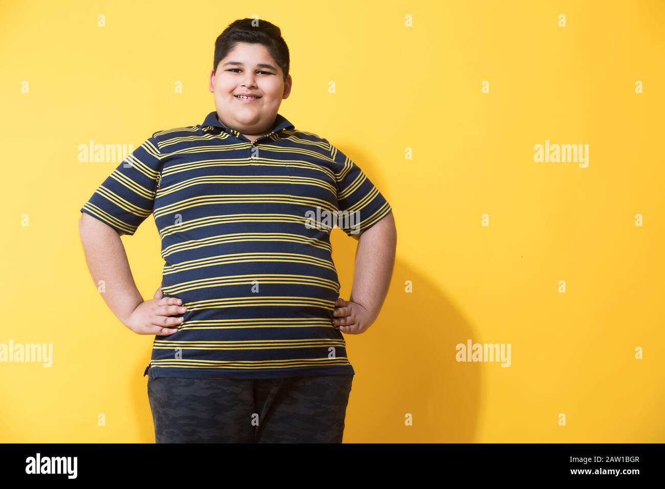 Obese boy standing and posing. (Obesity) Stock Photo