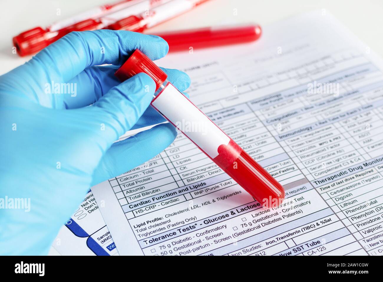 Doctor's hand holding red blood vial with blood sample and filling test