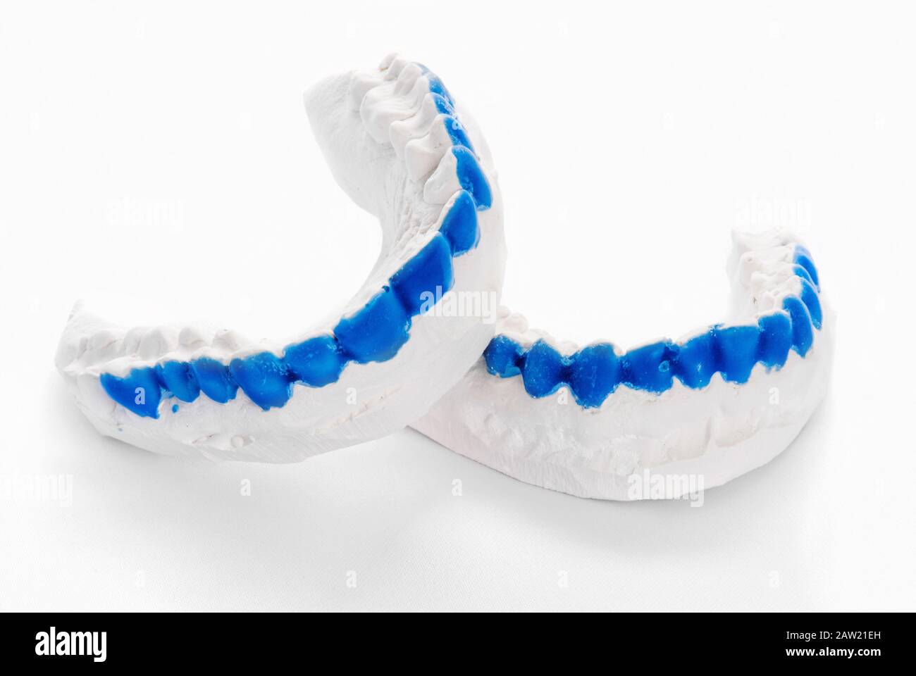Plaster dental molds with the teeth painted bright blue. This is the