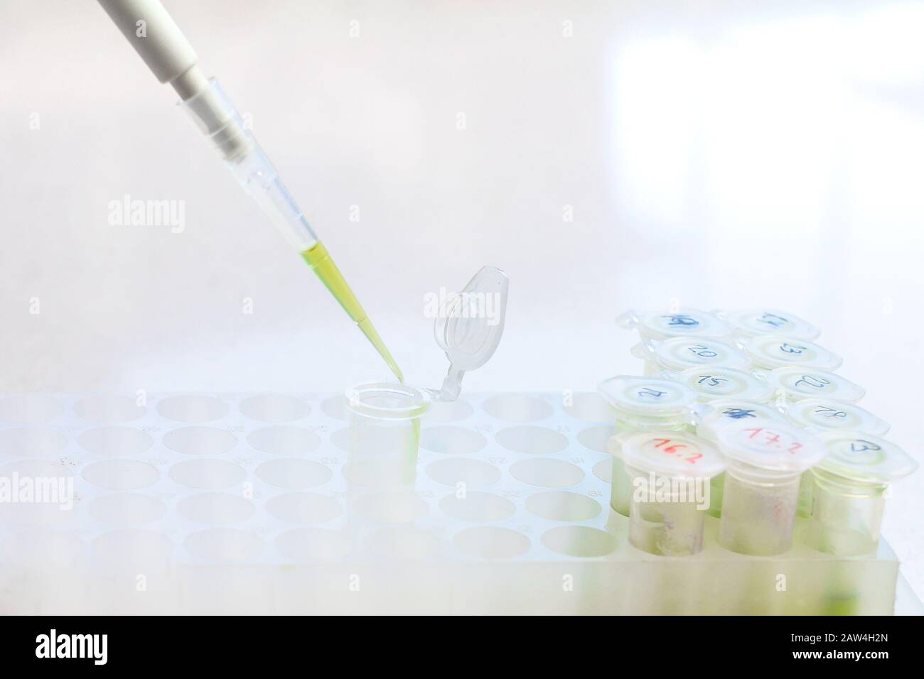 Clinical laboratory in process of chemical analysis. Collection of