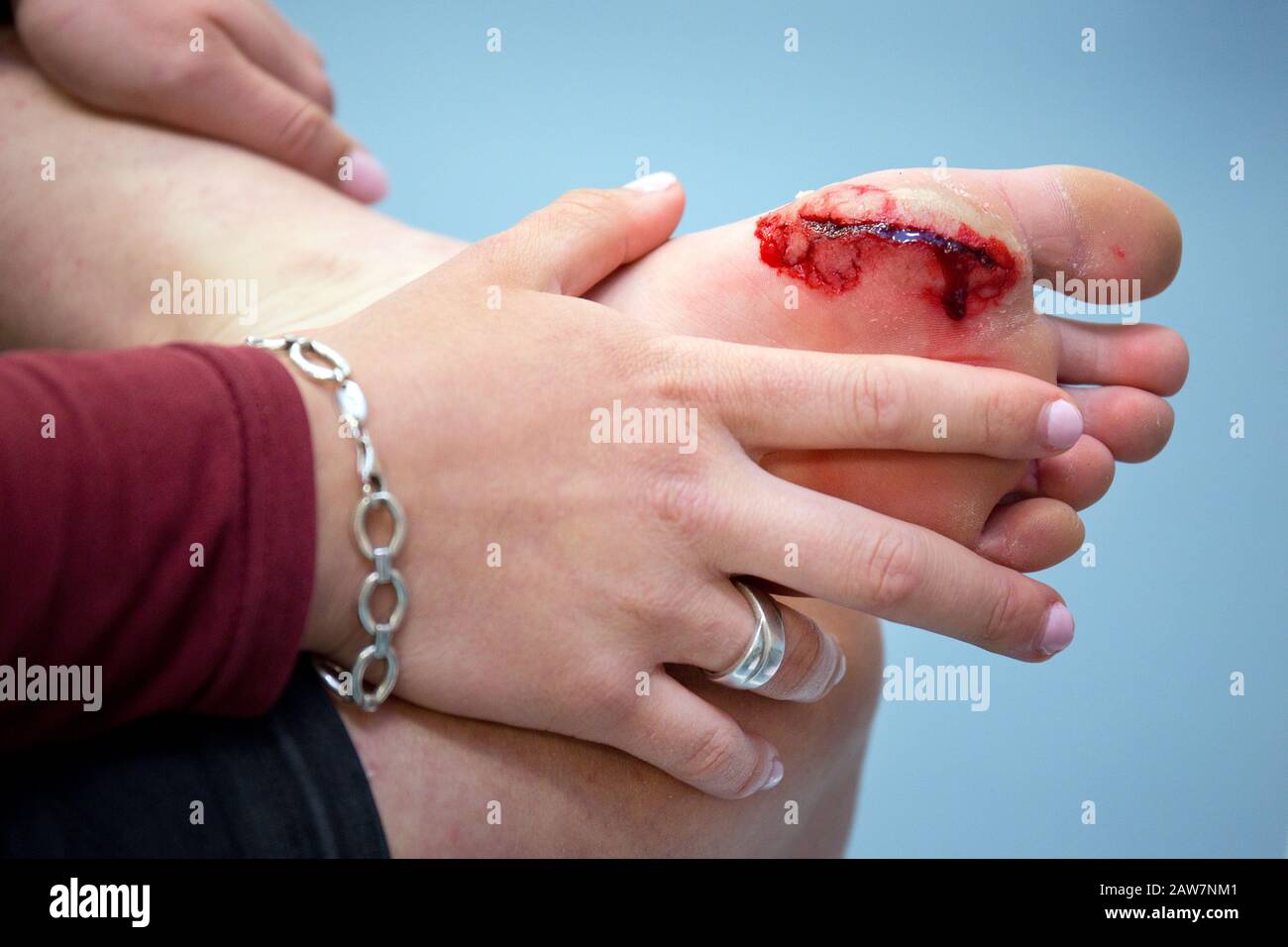 Large cut on the left foot through glass gives an ugly wound with a lot of blood Stock Photo