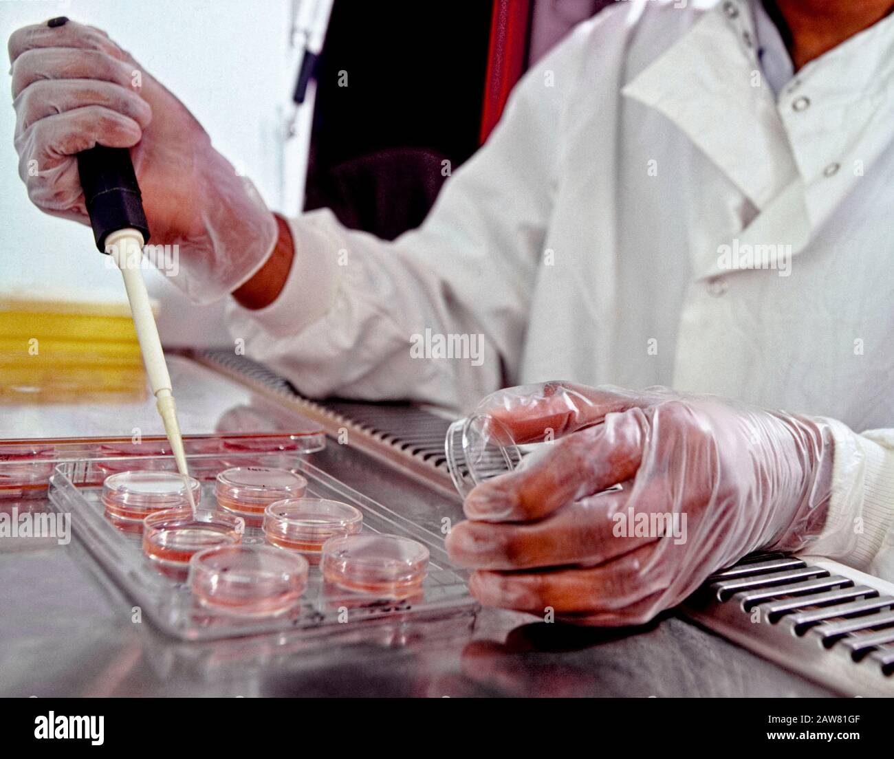 Hela Cells High Resolution Stock Photography and Images Alamy
