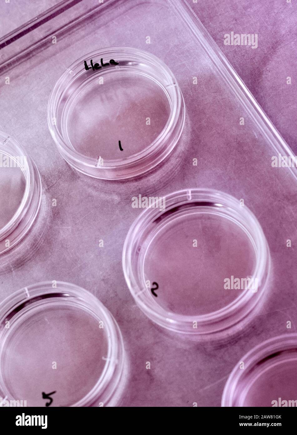 Cervical Cell High Resolution Stock Photography and Images - Alamy