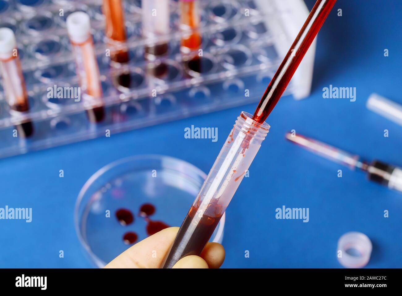 Microbiology Lab Tests