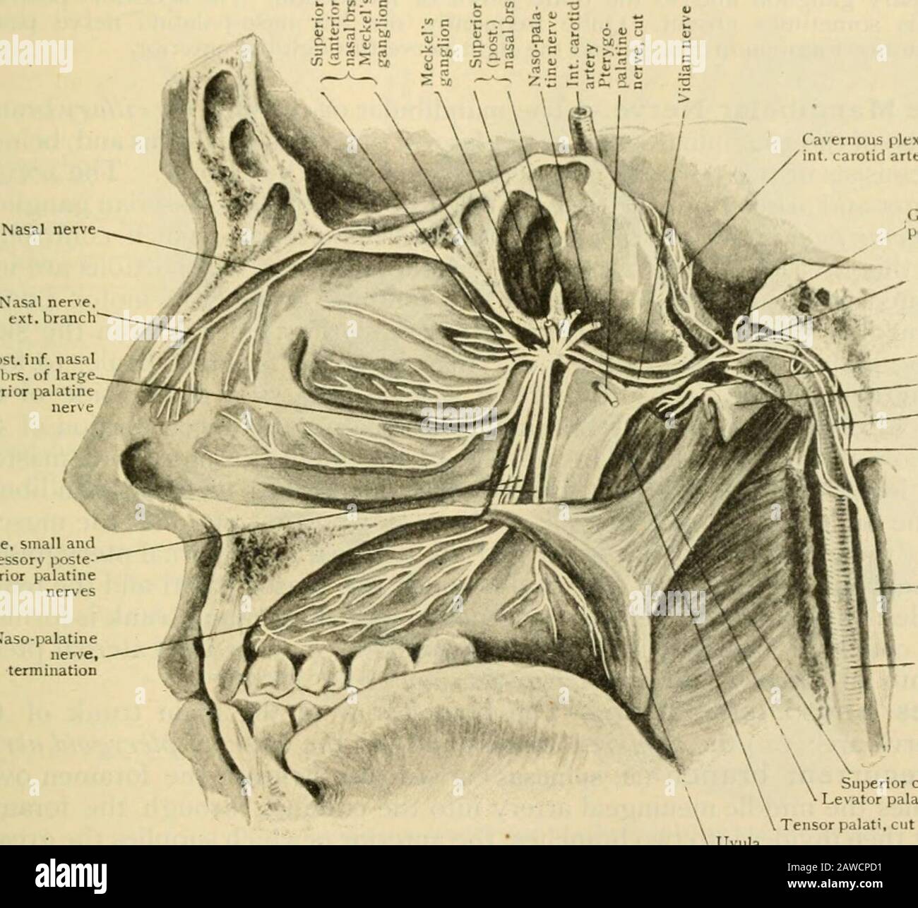 ethmoidal bulla cadaver