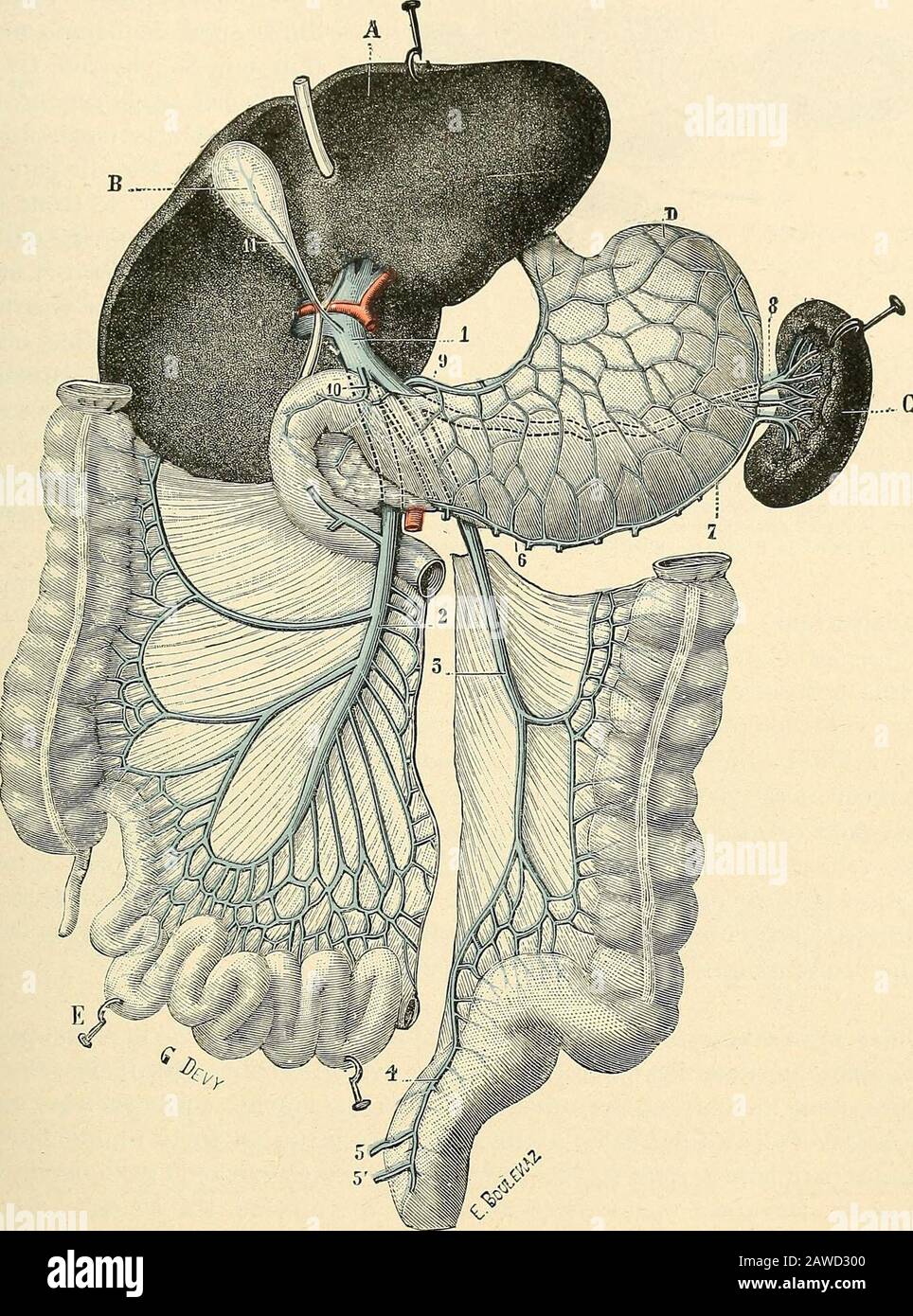 Traité d'anatomie humaine . os intestin) et par sa convexité toutes les veines de Vin-testin grêle (voy. Intestin grêle). Ces différentes veines intestinales, comme nousle verrons plus loin en étudiant la circulation du tube intestinal, sanastomosentplusieurs fois entre elles au sortir de lintestin et forment ainsi deux ou troisséries darcades, rappelant assez bien les arcades artérielles que nous avonsdéjà rencontrées sur le trajet des artères mésentériques. Fig. 2-23. Schéma de la veine porte. 1, Ironc de la veine porle. — 2, 3, 4,ses Irois branches radiculaires (grandemésaraïque, petite més Stock Photo