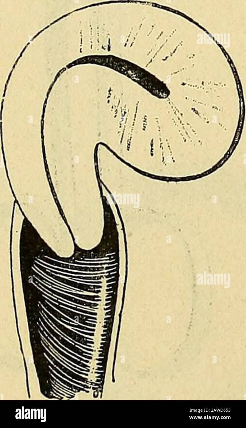 Eng yomon porno film Graf Orlov