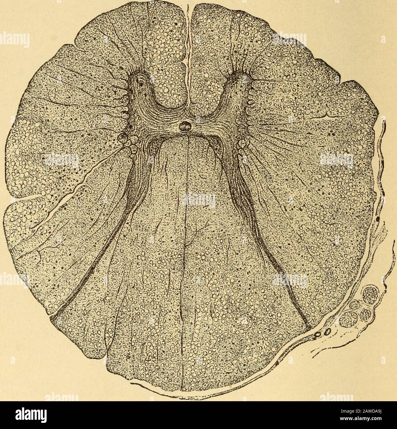 Diseases of the nervous system .. . moderately marked myelo-meningitis ...