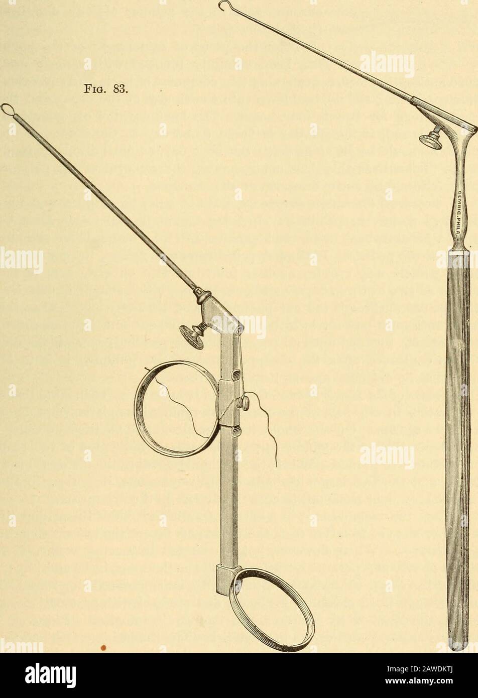 A text-book on diseases of the ear, nose and throat . the loopmay be turned nearly at right angles to the canula, so that it can beplaced over the polyp without the canulas interfering with a view of theoperation. Now a gentle traction on the trigger will draw the loop intothe canula and constrict the pedicle. The polypus is almost always re-tained in the tightened loop and is removed with the instrument. If it isnot, it can be syringed from the ear or drawn from it with slender forcepsor a cotton-holder. If there is another polyp in the ear it will be revealed after theremoval of the first, a Stock Photo