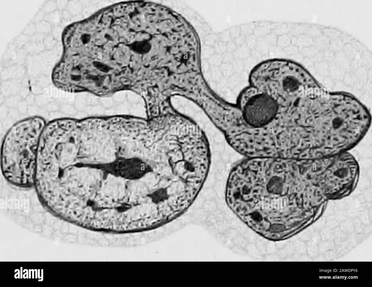 Clinical and pathological papers .. . 10. :. n. Digitized by Microsoft® , VerlaS voa Gustav Fischer in Jena Lith.Anst-v.KWesser.Jena. Digitized by Microsoft® resisunntt tur K.flerUvig. Bd. I. .. I Taf. 2. Stock Photo