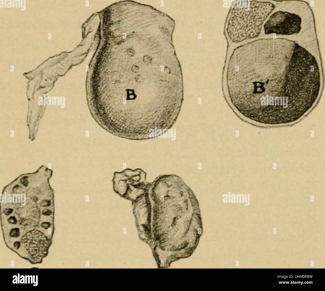 Veterinary obstetrics, including the diseases of breeding animals and of  the new-born . Fig. 16. Normal and Cvstic Ovaries of Cow. A. B, B, Cystic  ovaries. B, Section of B. showing it