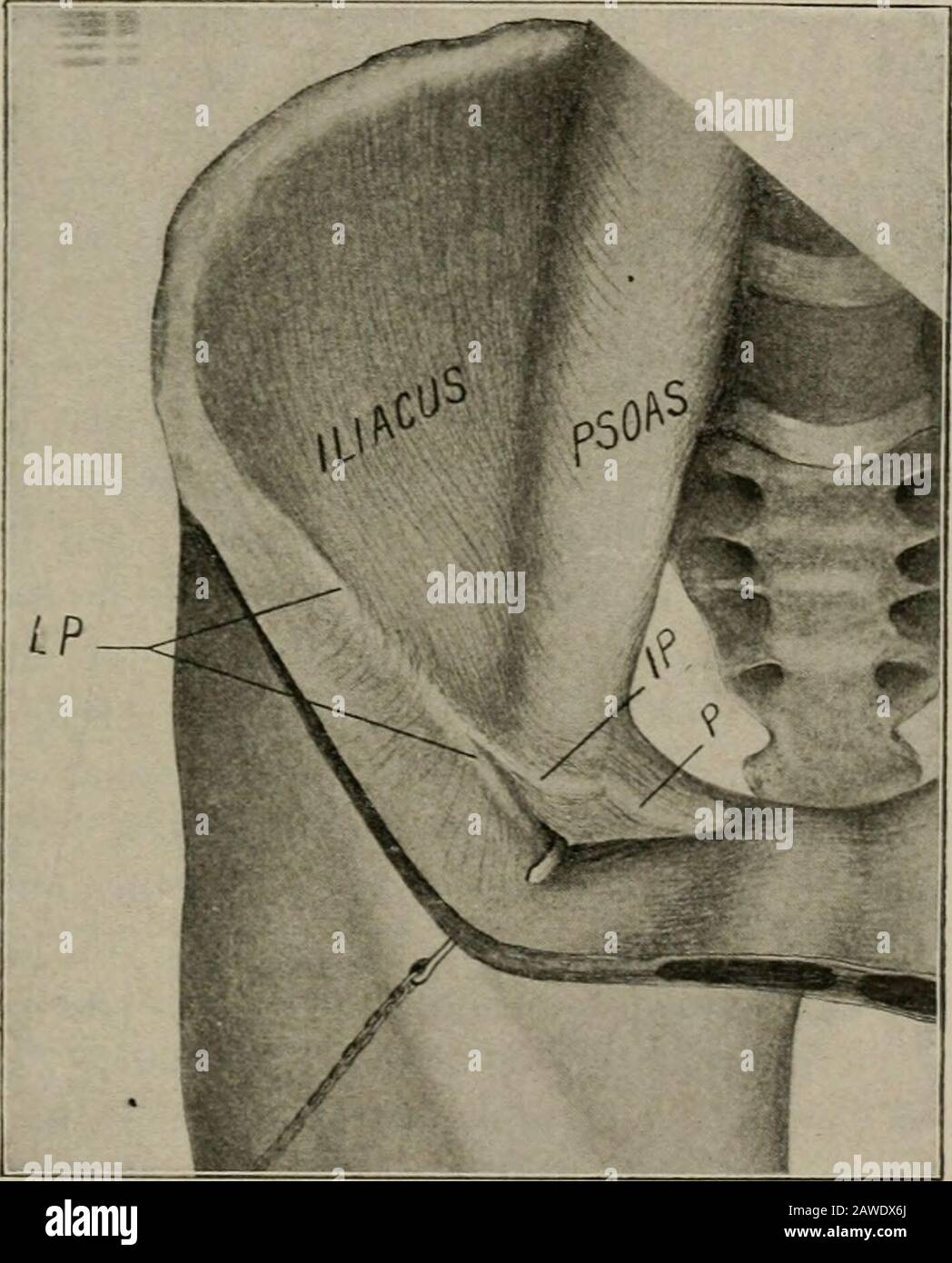 Operative surgery, for students and practitioners . Fig. 273.—The Pelvis  and Ligaments of the Ilio-pubic Region. FS, femoralspace; G, Gimbernats  ligament; IP, ilio-pectineal ligament; IPS; ilio-psoasspace; P, Pouparts  ligament; PS, pubic spine..