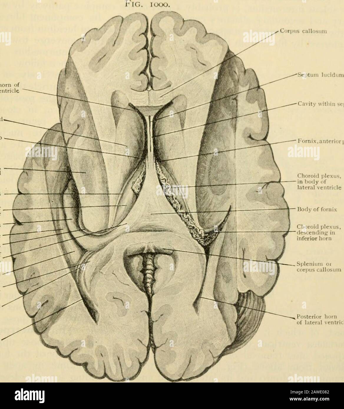 Human anatomy, including structure and development and practical considerations . .,dy towards the ventricle incorrespondence with the convexity of tiie massive head of the caudate nucleus. Thefloor of this part of the ventricle is narrow, often a mere j^roove alonij the junction ofthe slopino- lateral and vertical mesial wall, and in front i)asses insensibly into theconcave anterior wall, formed by the lateral part of the hind surface of the m-nu ofthe corpus callosum. The body (pars centralis) of the lateral ventricle includes that part of the spacewhich extends from the foramen of ^b)nro to Stock Photo