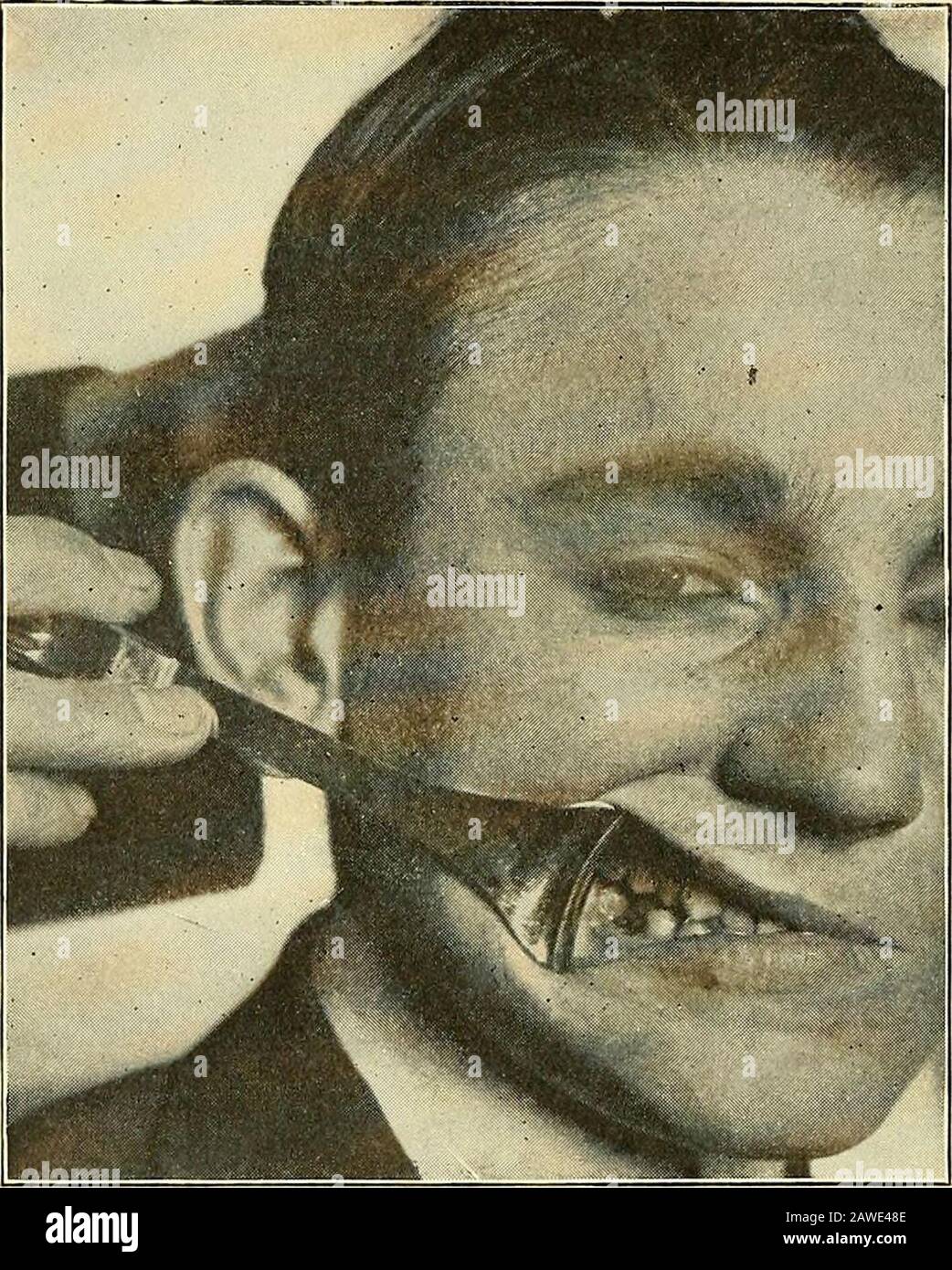 Oral surgery; a textbook on general surgery and medicine as applied to