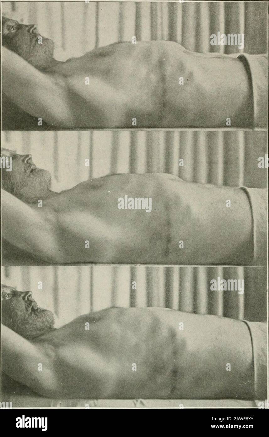 Diseases of the chest and the principles of physical diagnosis