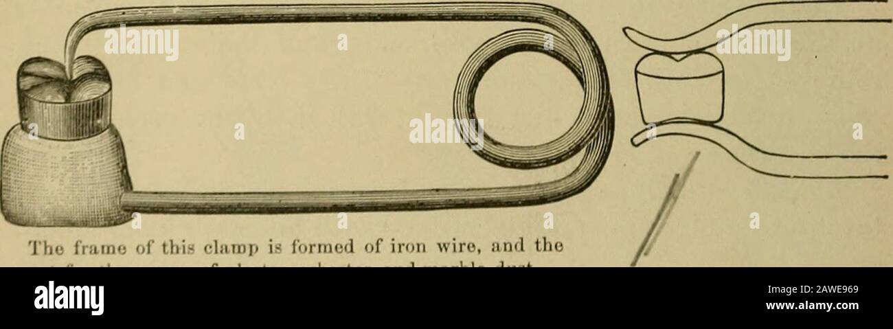 A Practical Treatise On Artificial Crown And Bridge Work 86 Can With Practice Be Completed Infive Minutes With This Die Thecap Is Then Struck Up On Thelead From A Flat Piece Of Plateand A Practical Treatise On Artificial Crown And Bridge Work 86 Can With Practice Be Completed Infive Minutes With This Die Thecap Is Then Struck Up On Thelead From A Flat Piece Of Plateand