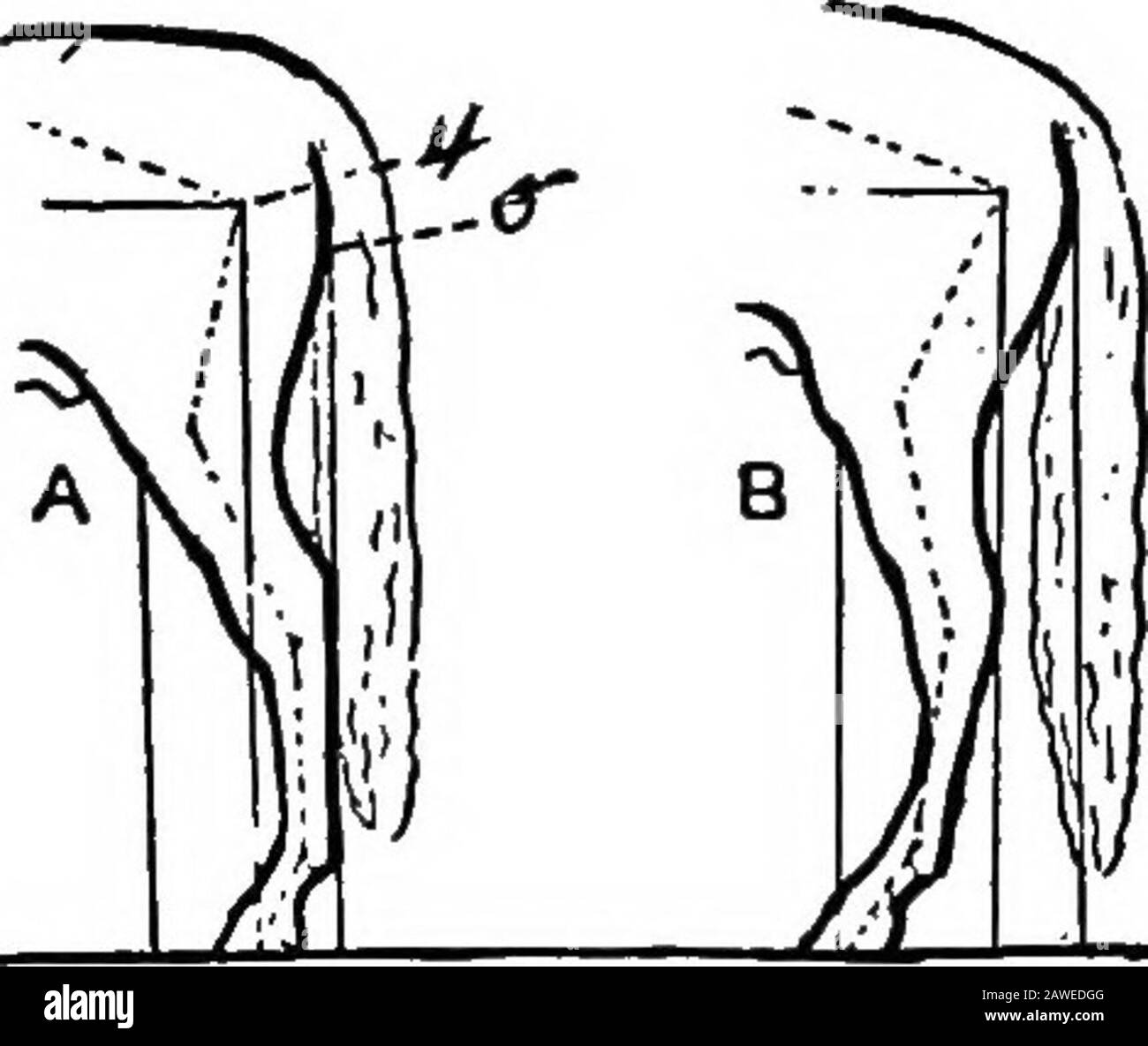 Knee elbow position Black and White Stock Photos & Images Alamy
