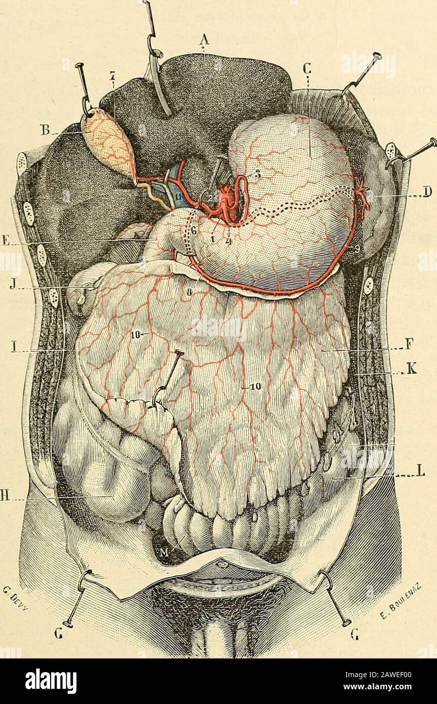 Traité d'anatomie humaine . ir le pancréas, la rateet le duodénum.) A, estomac. — B, duodénum. —C, jéjunum. — D, pancréas. — E,rate. — 1, aorte. — 2, tronc cœliaque. — 3, artère liépaliiiue, avec : 3, gaslro-épiploïque droite ; 3, artère pjlorique. — 4, coronaire stomachique. — 5, splénique, avec: 5, ses rameaux pancréatiques; 5,gastro-épiploïquegauche; 5, ses vaisseaux courts; ov, ses branches épiploïques coupéesà quelques centimètres de leur origine. — C, brandie pancréalico-duo-dénale de la gastro-épiploïque droite, formant avec une branche de7, lartère mésentérique supérieure, larc pancréa Stock Photo