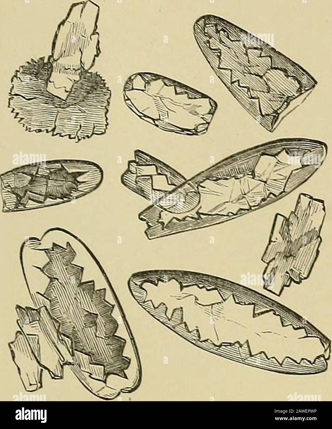 Kidney diseases, urinary deposits, and calculous disorders their