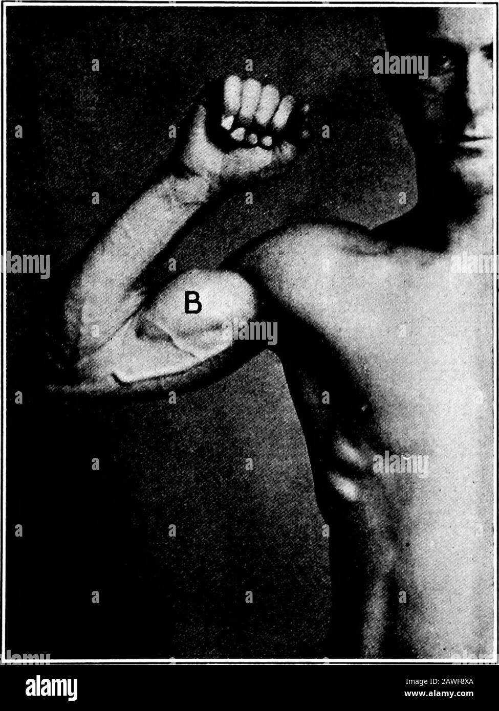 Applied anatomy and kinesiology, the mechanism of muscular movement . OIDPROCESS STYLOIDPROCESS STYLOID IPROCESS POSTERIORBORDER BSTYLOID?PROCESS Fig. 67 Fig. 68 Figs. 67 and 68.—The radius and ulna. (Gerrisb.) the like; in all forcible supination, as in turning a screw-driver toturn a screw in with right hand or out with left; when the armis raised sideward it seems to contract during a horizontal swingof the arm forward, but this may be done to protect the elbowagainst injury from overextension, which the movement tends toproduce. BICEPS 121 When the biceps is stimulated by electricity it fl Stock Photo