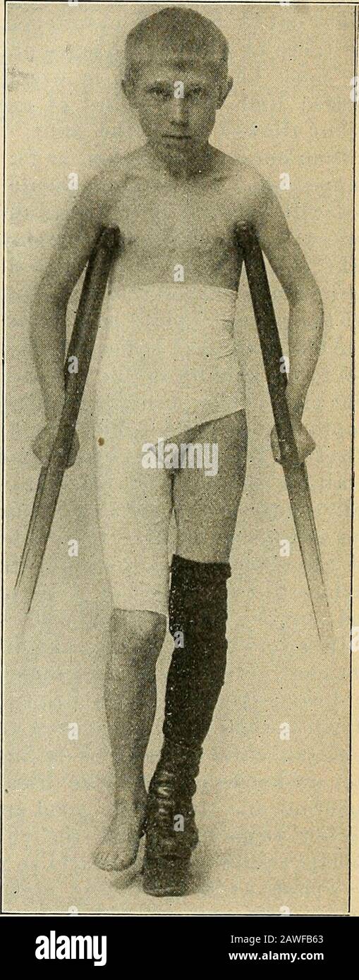 An American textbook of the diseases of childrenIncluding special